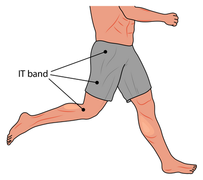 IT Band & Running Pain